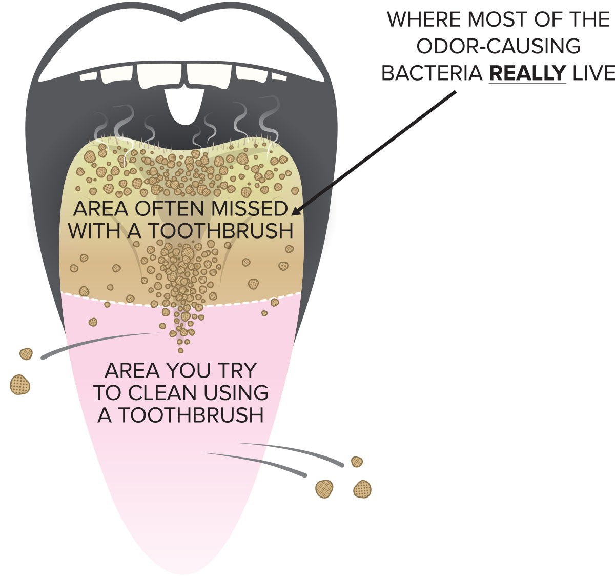 Illustration: Bacteria on the back of the tongue