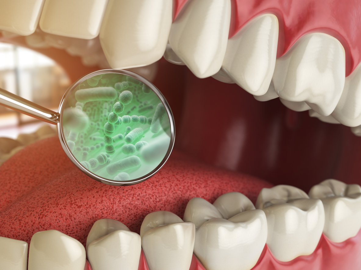 Closeup of mouth showing bacteria on the tongue